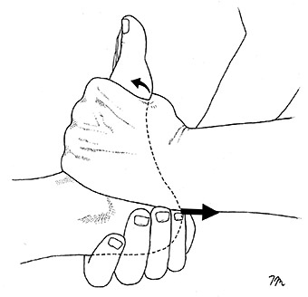 Hoover cord maneuver