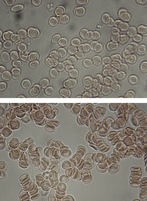 Blood Zeta Potential