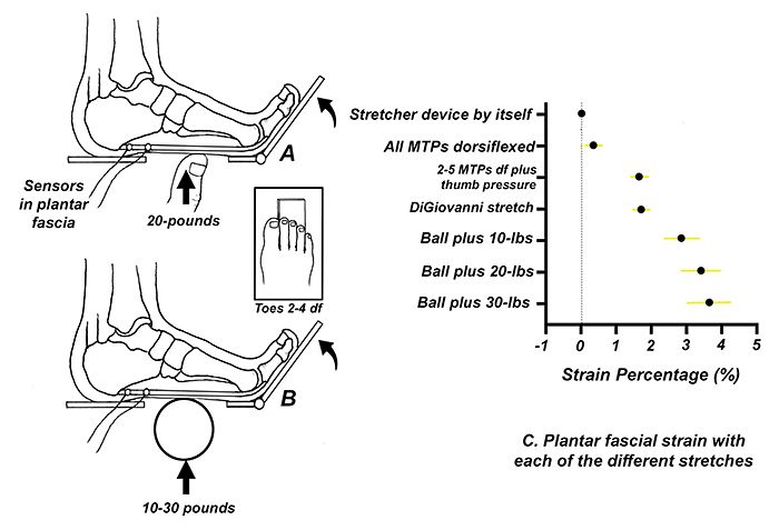 alternate plantar fascial stretches