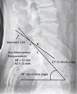 Clinical Presentation & Adjustment: Base Posterior Sacrum