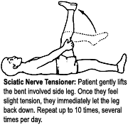 Increased neural tension in the sciatic nerve: Causes, tests, and exercises