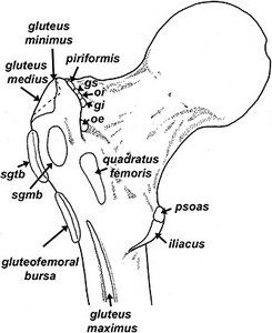 Greater Trochanteric Bursitis - Excel Spine