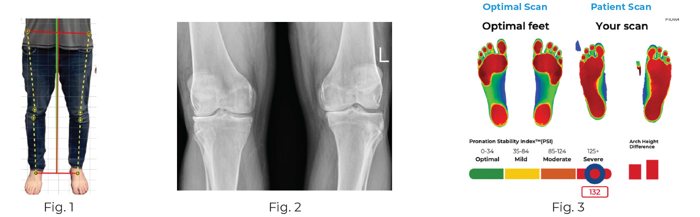 Initial Exam Findings