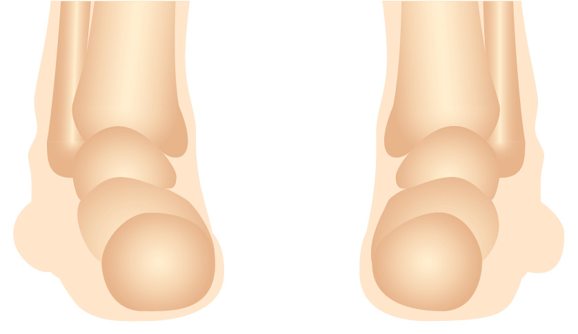 lower cervical, upper/mid thoracic area