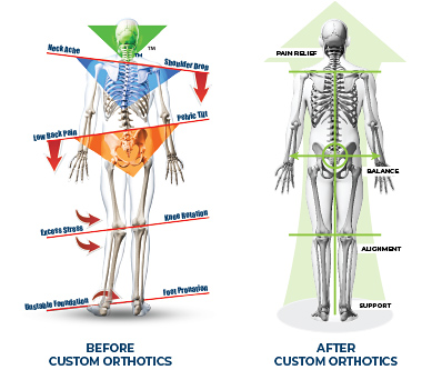 Structural Support
