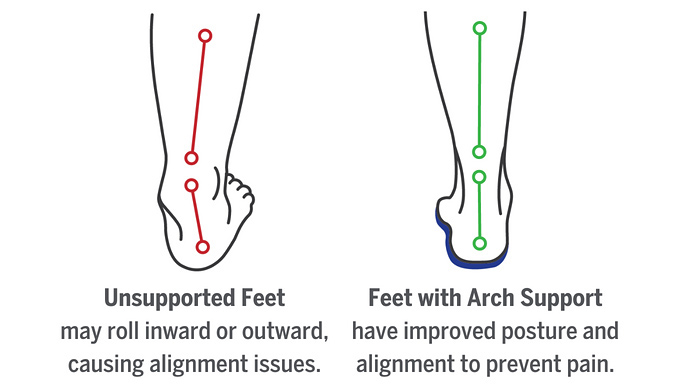 Sandals lacking proper support can lead to issues like plantar fasciitis