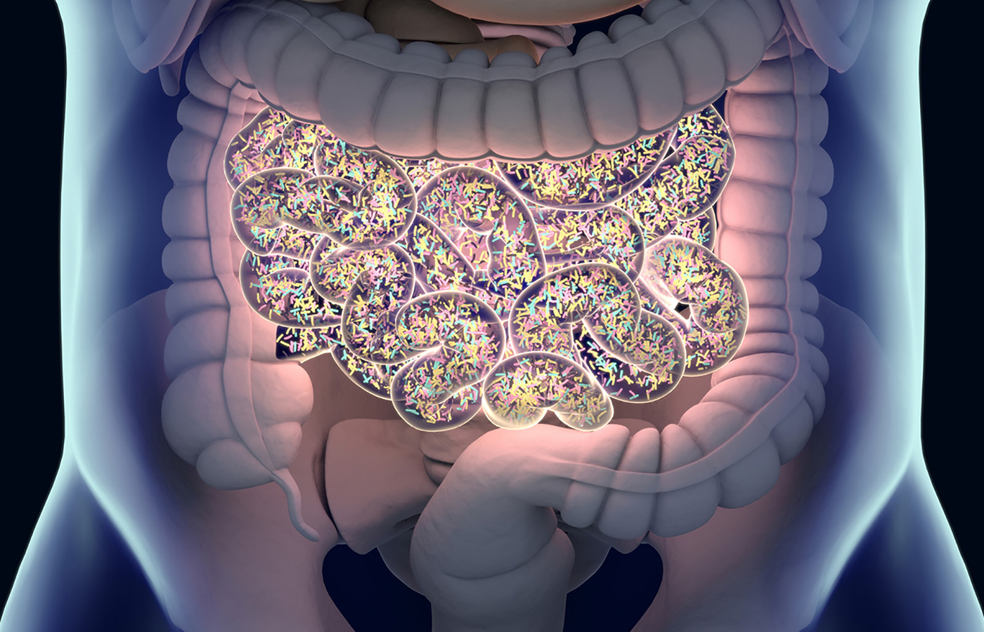 Promising Herbal Therapy Targeting Microbial Balance