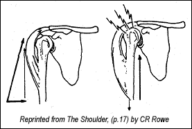 Does Your Patient Really Need Acromioplasty?