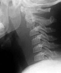 Normal Radiographic Differences Between the Adult and Pediatric ...