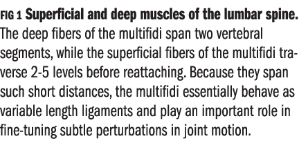 FIG 1 Superficial and deep muscles of the lumbar spine. The deep fibers of the multifidi span two vertebral segments,...