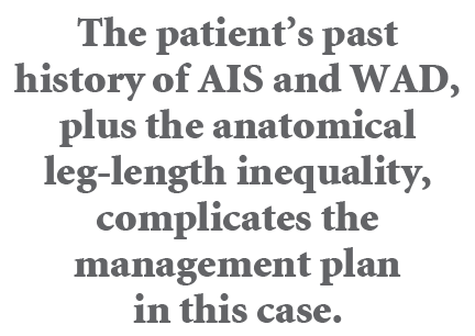The patient’s past history of AIS and WAD, plus the anatomical leg length inequality, complicates the management plan...