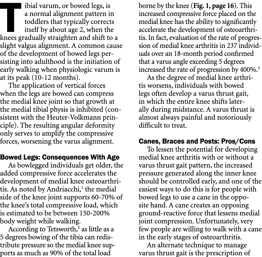 Tibial varum, or bowed legs, is a normal alignment pattern in toddlers that typically corrects itself by about age 2,...