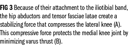FIG 3 Because of their attachment to the iliotibial band, the hip abductors and tensor fasciae latae create a stabili...