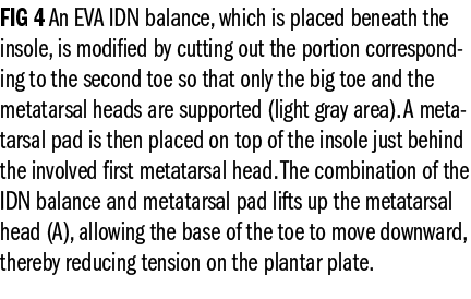 FIG 4 An EVA IDN balance, which is placed beneath the insole, is modi ed by cutting out the portion corresponding to ...