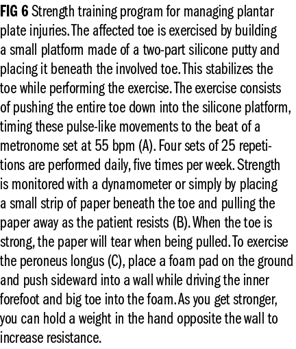 FIG 6 Strength training program for managing plantar plate injuries. The affected toe is exercised by building a smal...
