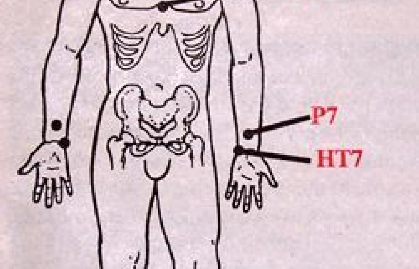 Insomnia Diagram