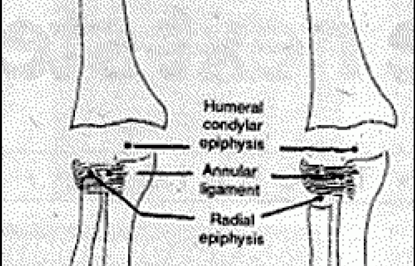 Figure 1 A&B