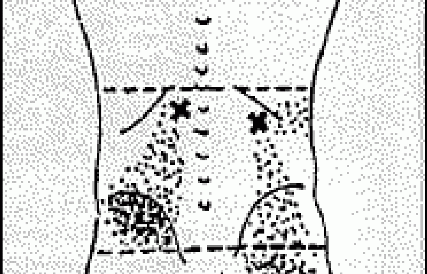 Lumbar Supports