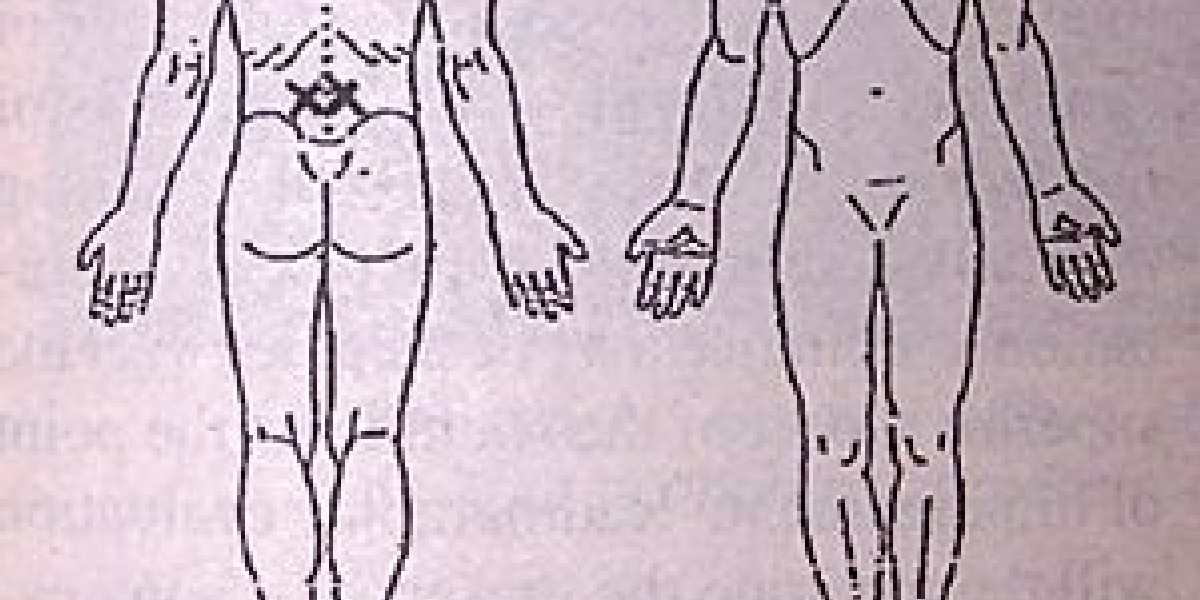 Pain Treedraw A Closer Look at Pain Drawings | Dynamic Chiropractic