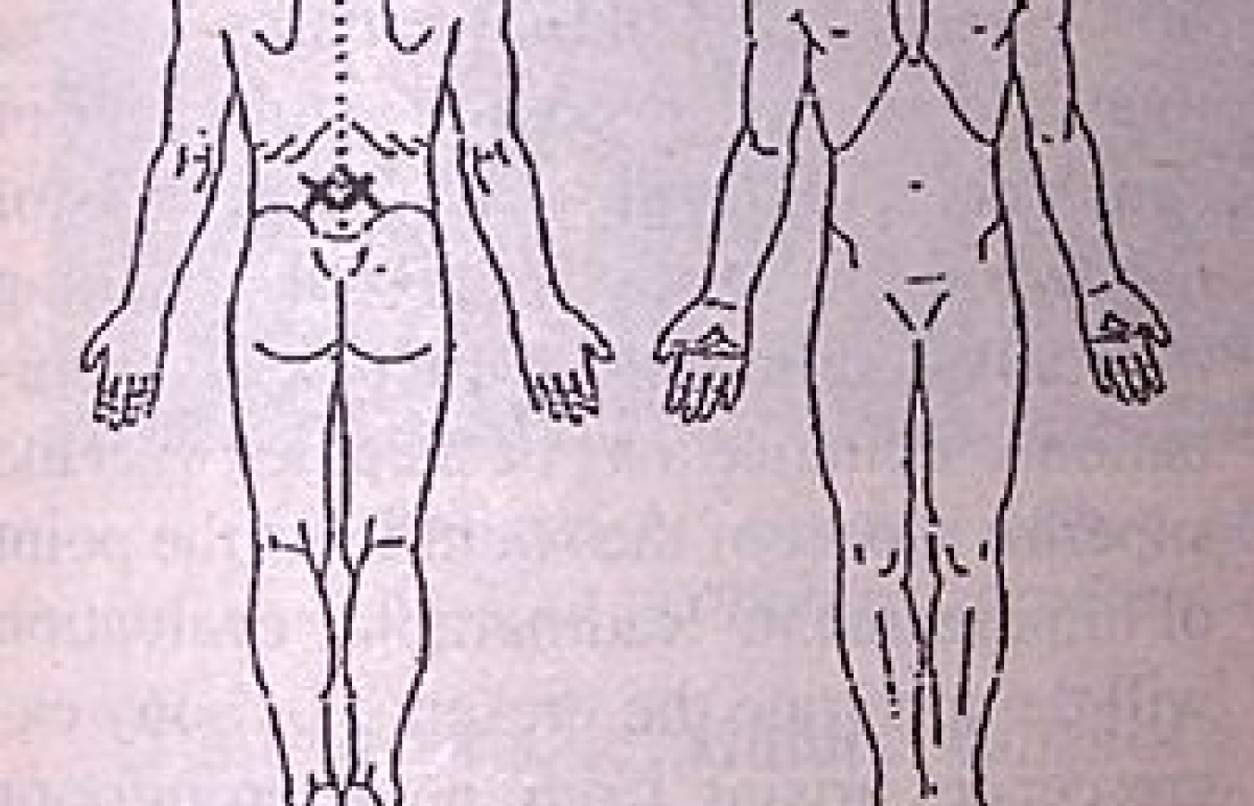 32-year-old male with minor low back pain