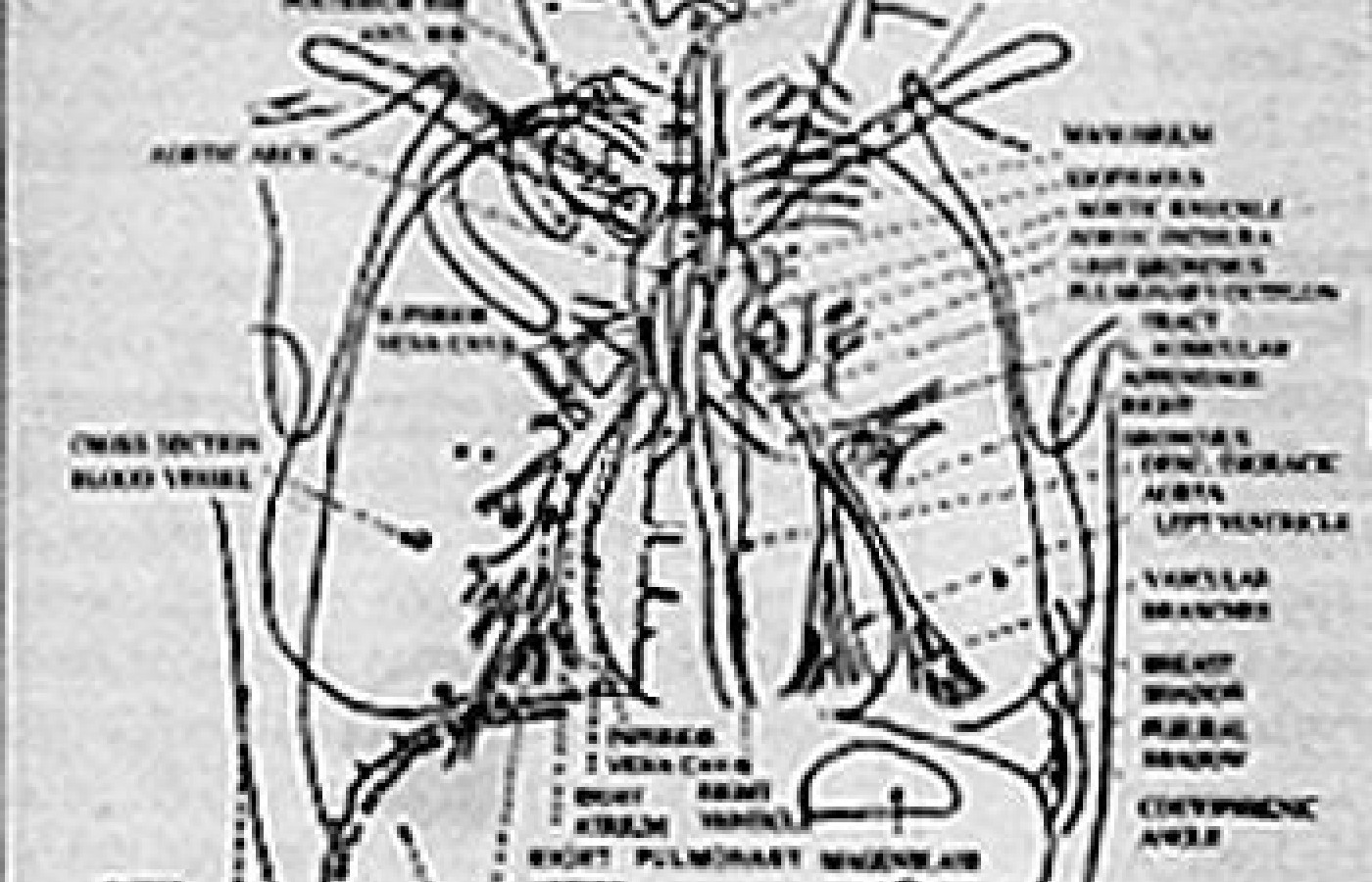 Chest Diagram