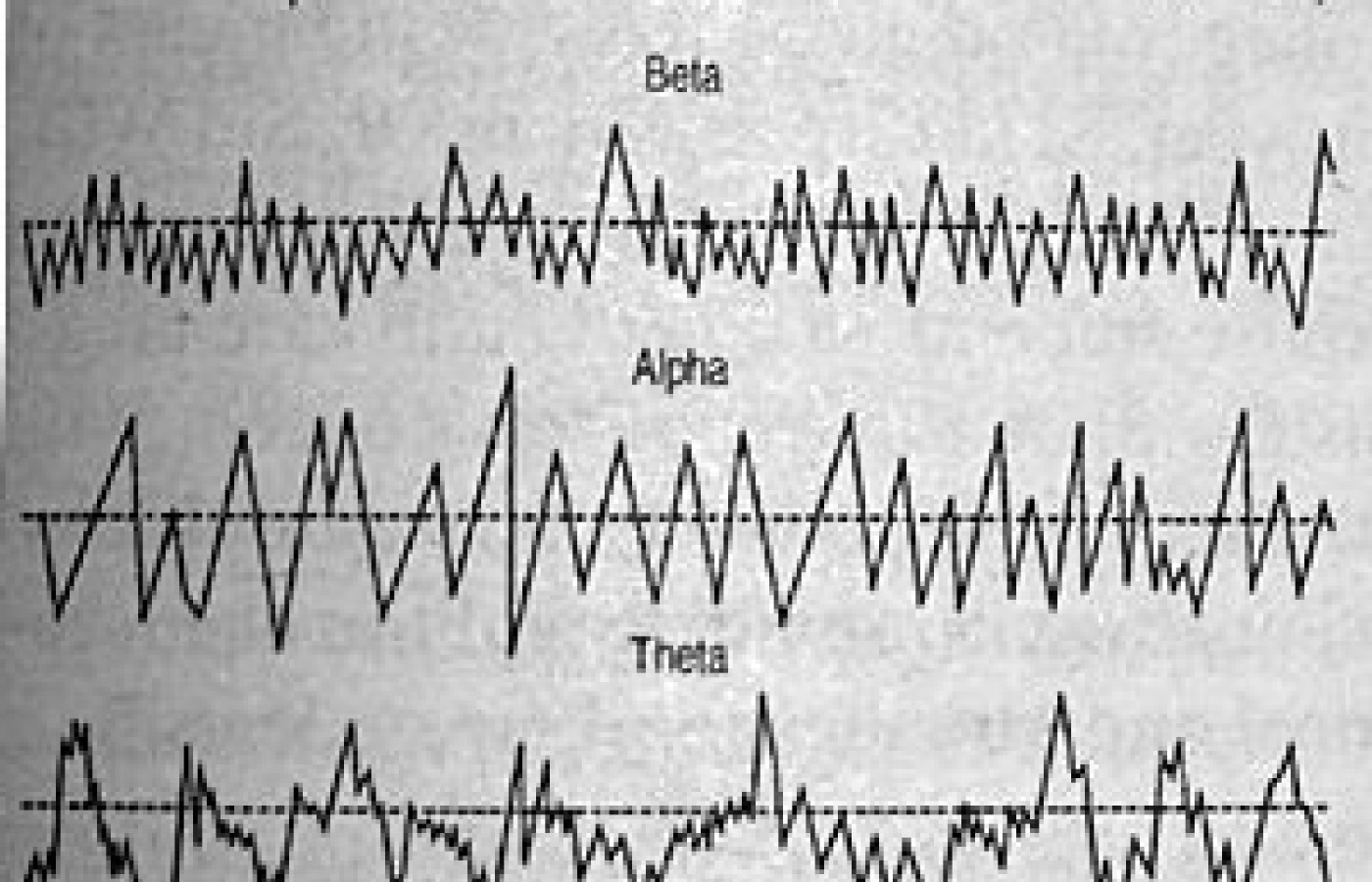 Brainwave Patterns