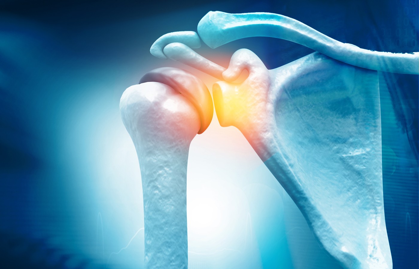 Class 4 Laser Therapy for a Rotator-Cuff Injury: Case Study