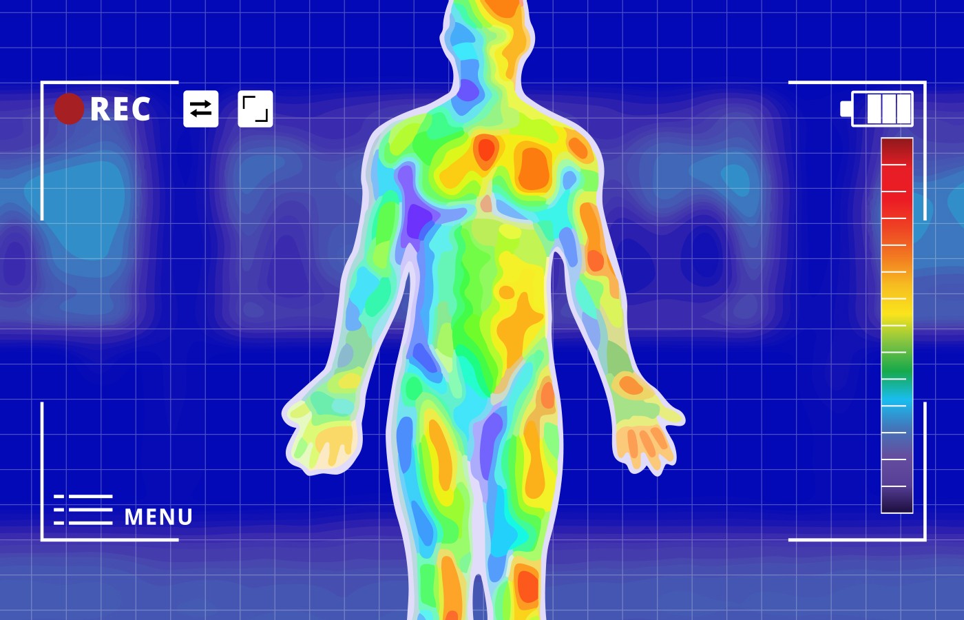 Musculoskeletal Thermography