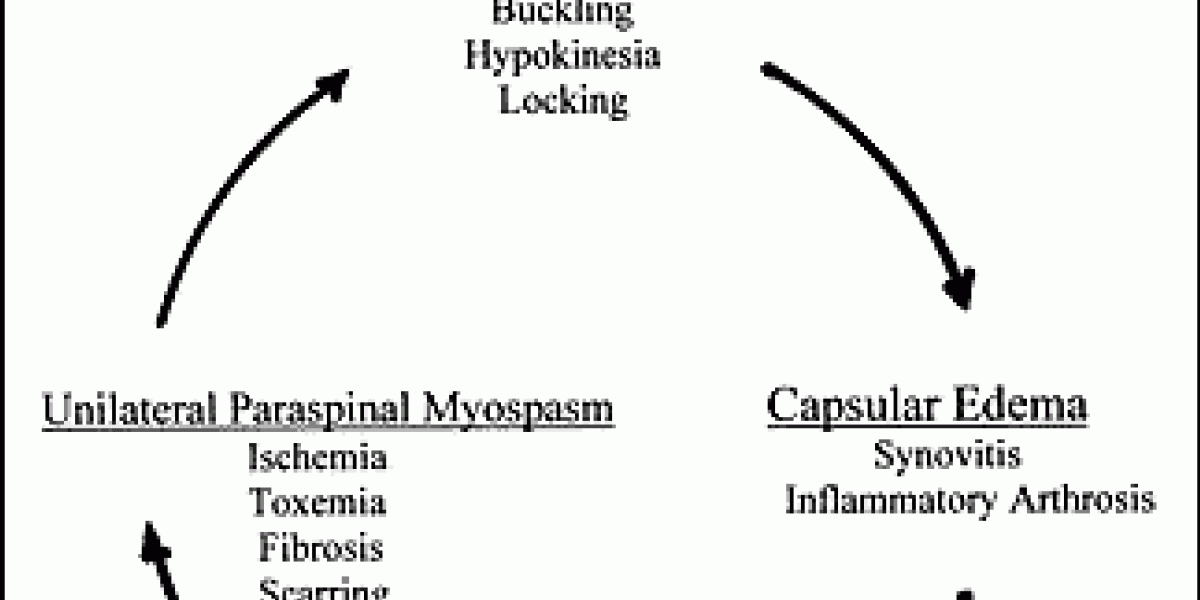 The Spinal Biomechanical Lesion: A Vicious Cycle | Dynamic Chiropractic