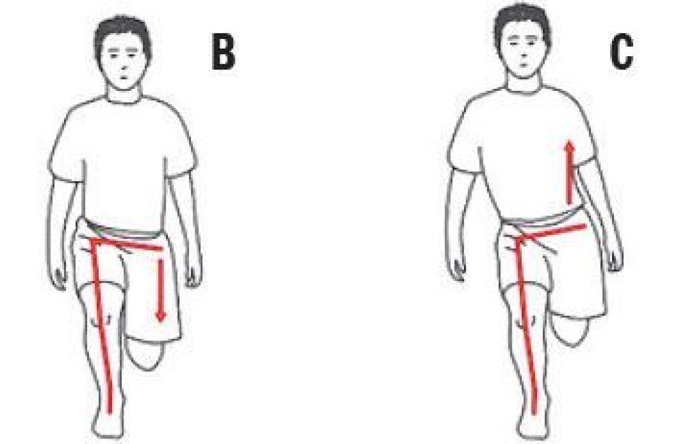 Dynamic Trendelenburg Test