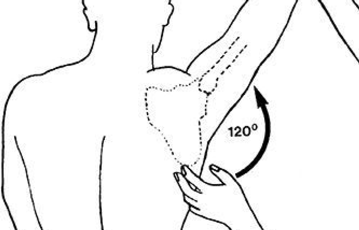 Scapulohumeral Rhythm