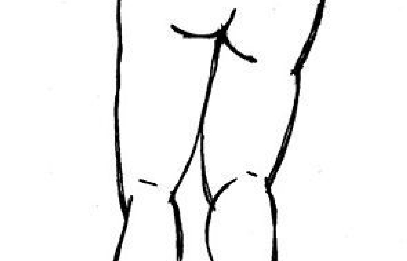 gluteus medius