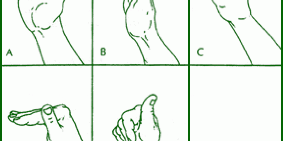 Carpal Tunnel Exercises that Work Dynamic Chiropractic