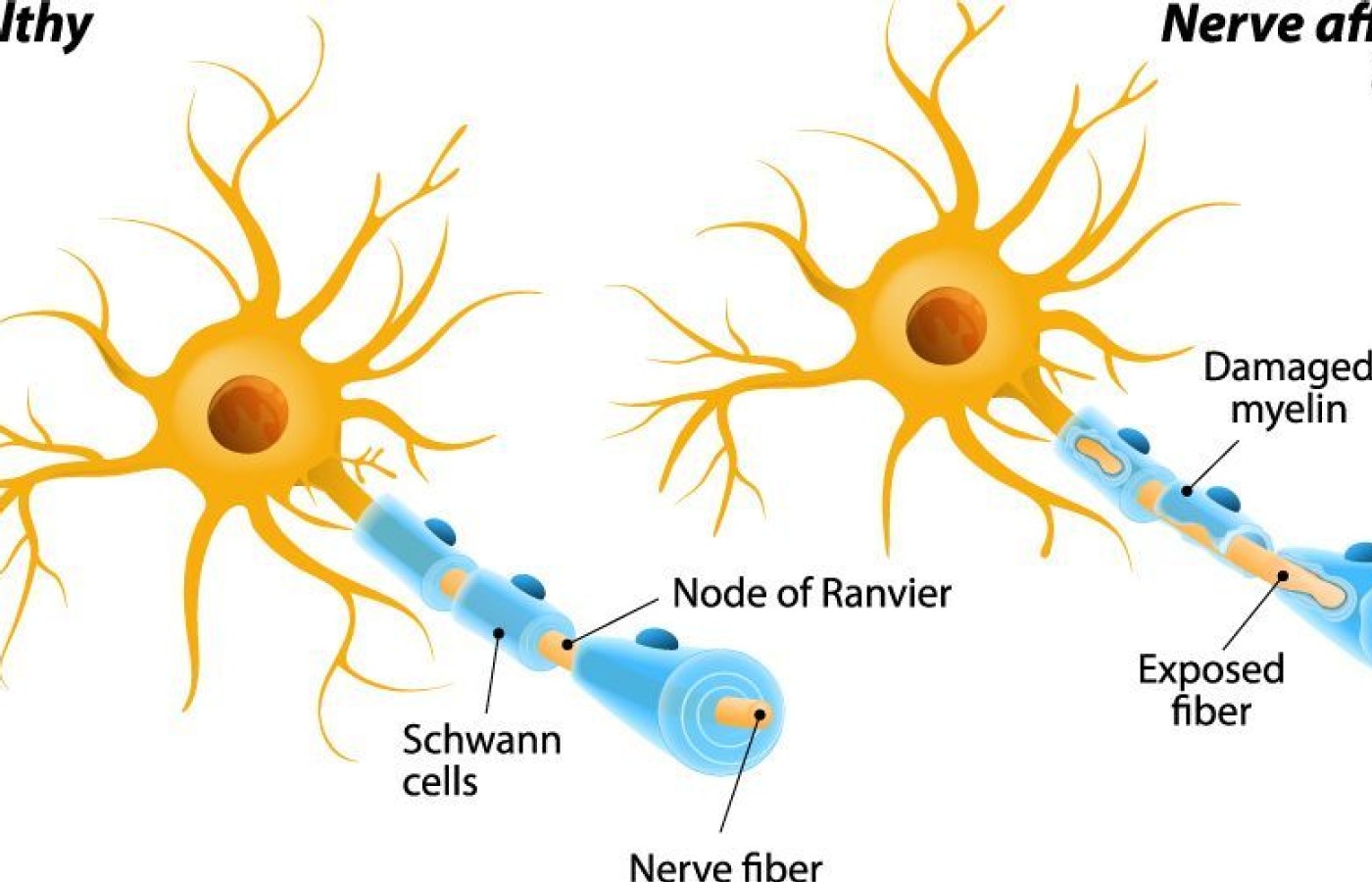 inflammatory markers