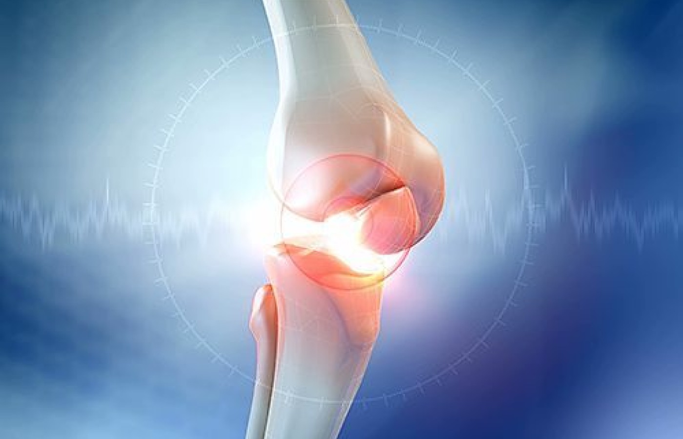 knee pain
