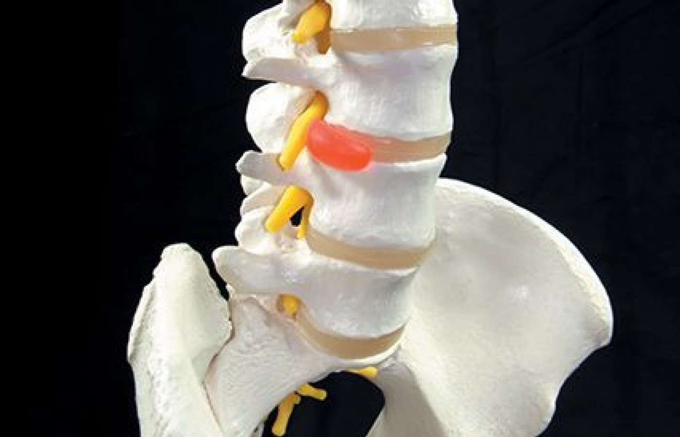 lumbar disc