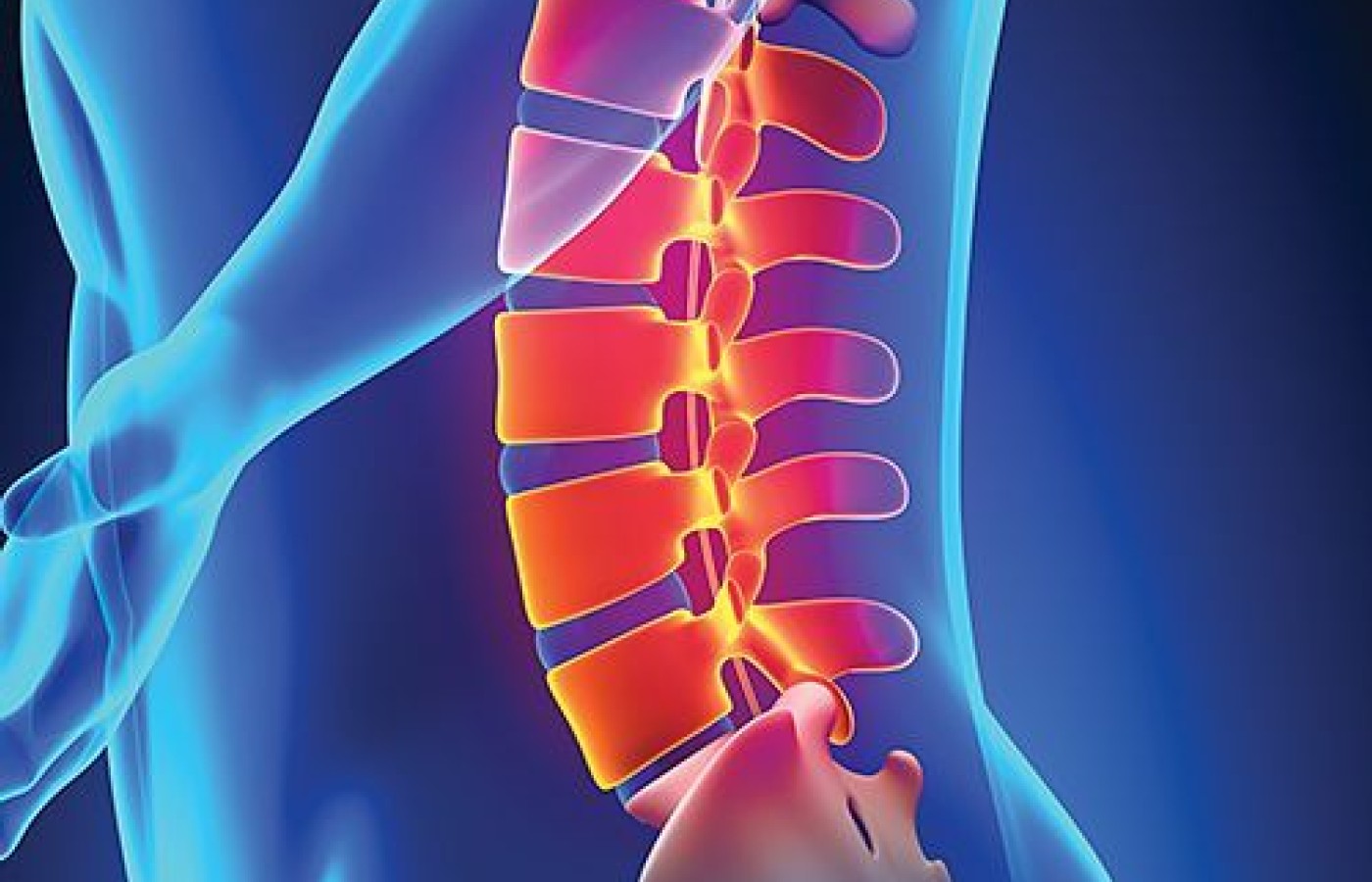 lumbar facet denervation