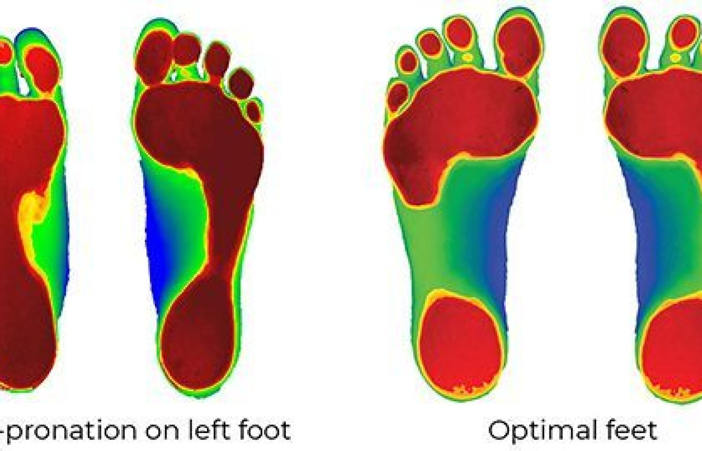 Foot scan
