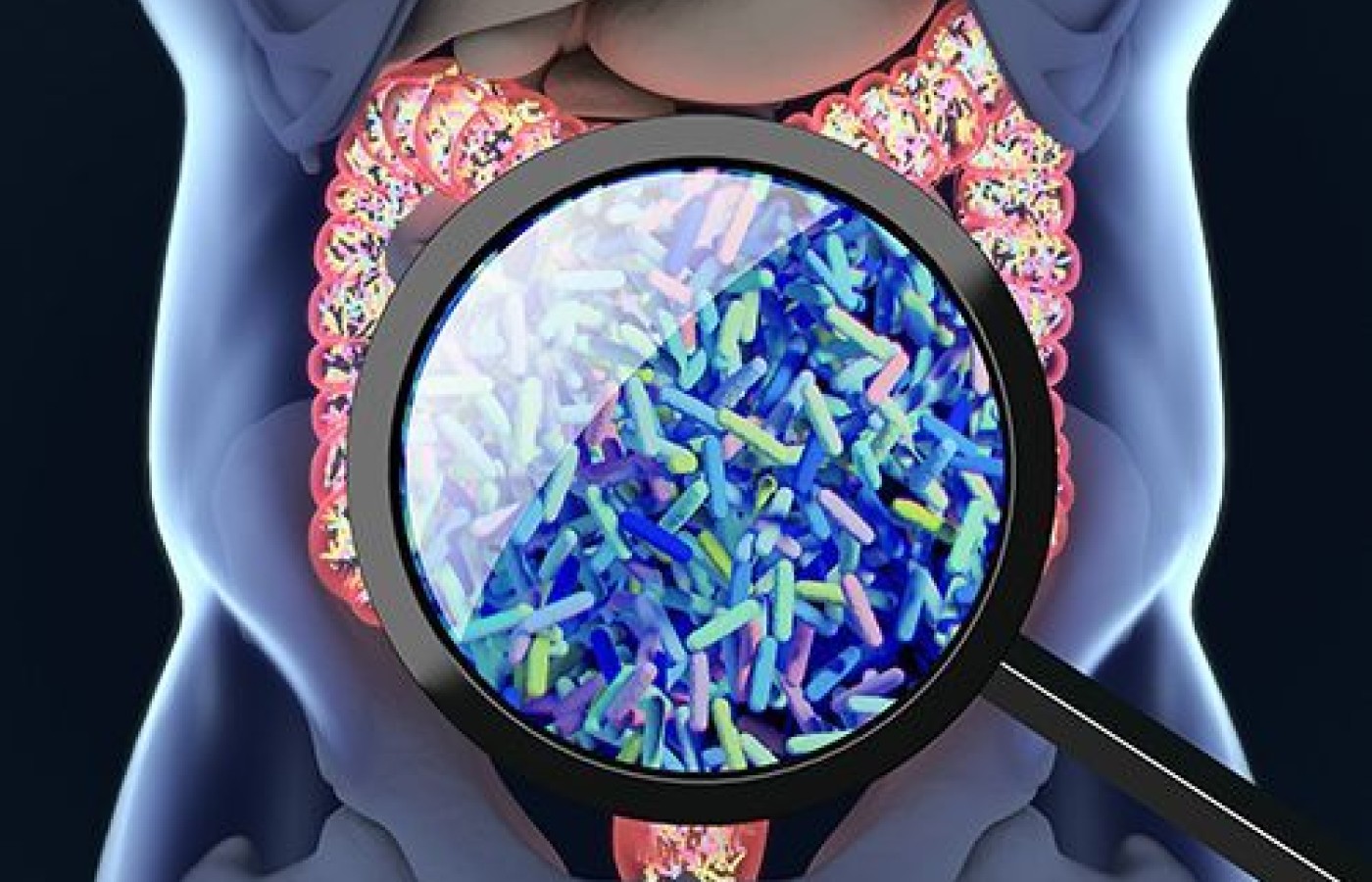 Microbiome