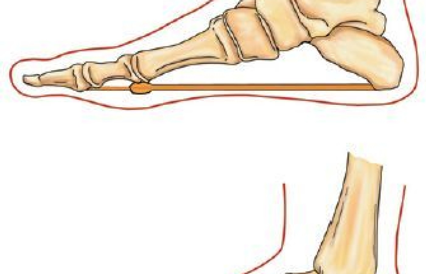 Dorsiflexion of the hallux