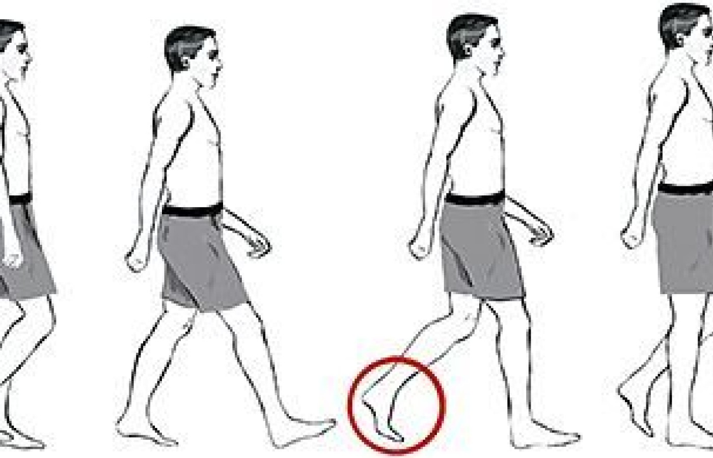 The gait cycle