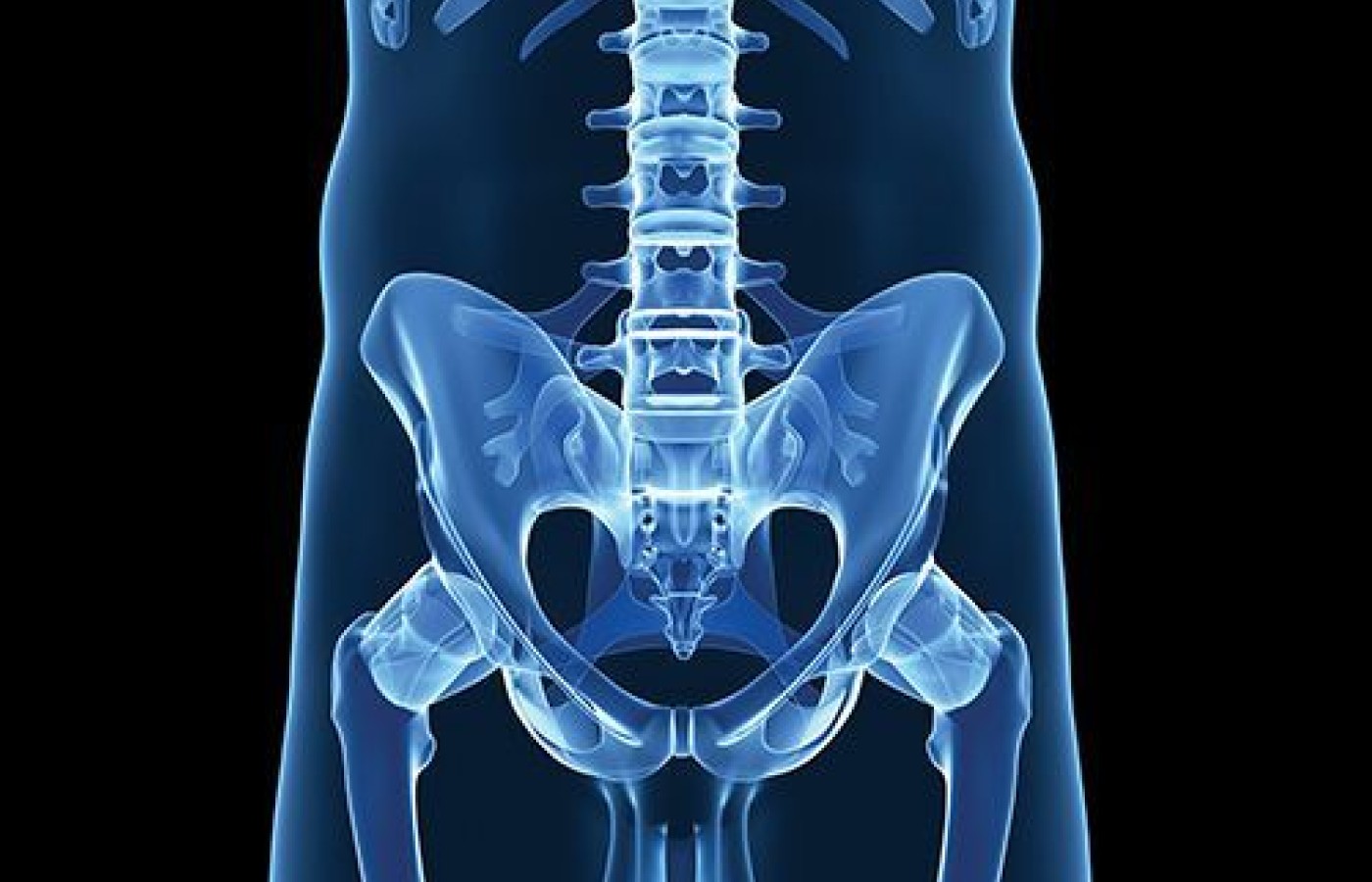 pelvic xray