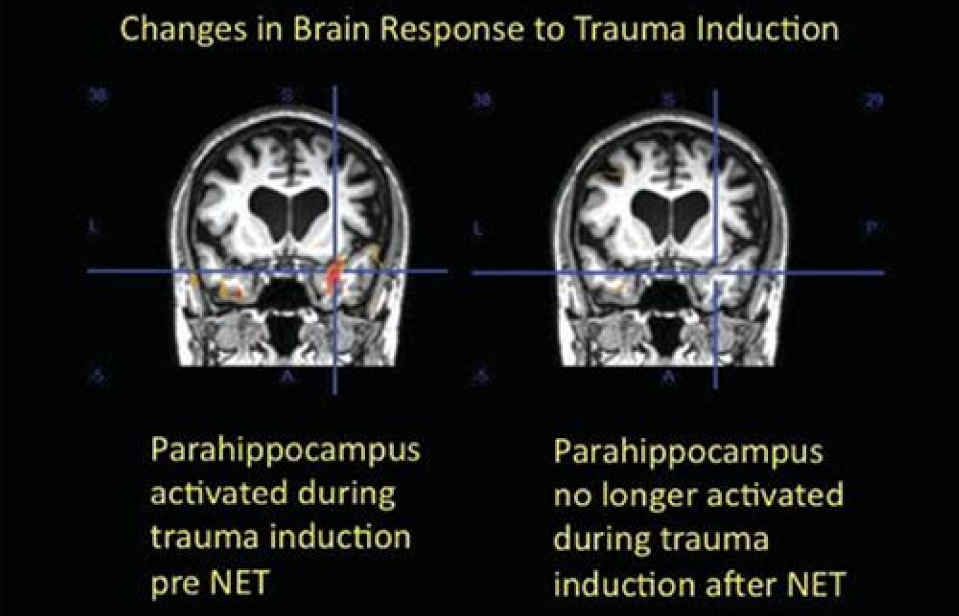 brain response