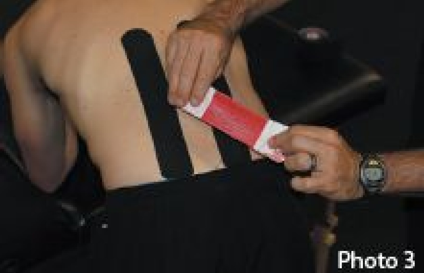 elastic therapeutic taping